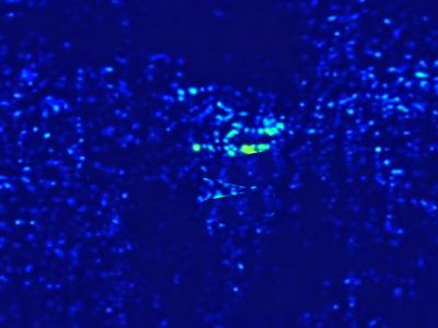 Radar (RR)